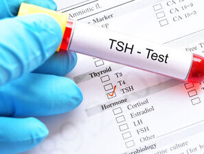 Bild zu Hoher TSH-Wert - Thyroxin geben?