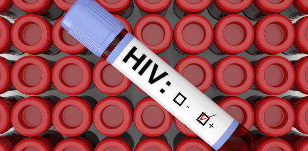 Bild zu AIDS - Weniger HIV-Infektionen