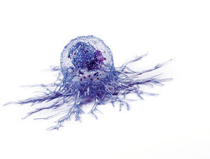 Bild zu Onkologische Tumoren - Schmerzen lindern mit System