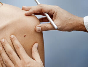 Bild zu Hautkrankheiten - Was ist häufig in der Hausarztpraxis?