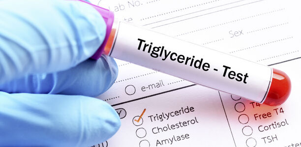 Bild zu Erhöhte Triglyceride - Auswirkungen auf das Atherosklerose-Risiko