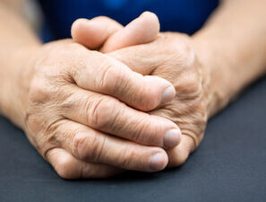 Bild zu Rheumatoide Arthritis - Diagnostik und Therapieoptionen